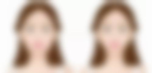 打完瘦脸针第二天脸肿了怎么回事儿?区分生理性和异常性肿胀