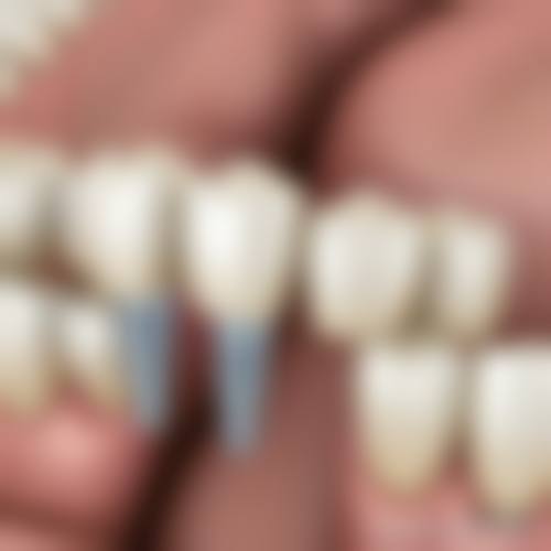 标准化服务流程与患者保护