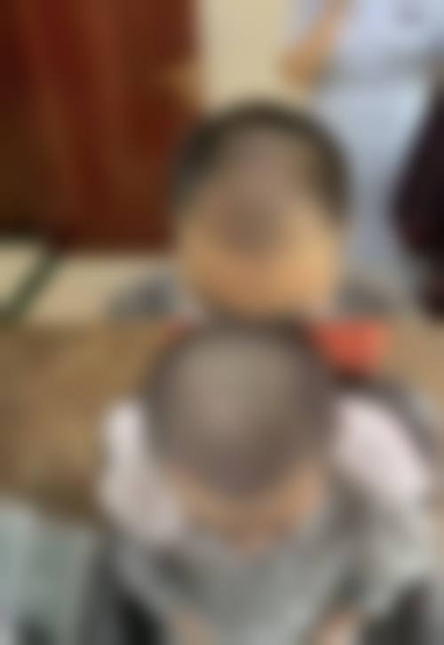 常州朱珠安整形医院患者口碑评价