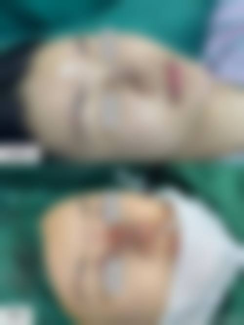 临床实例分享