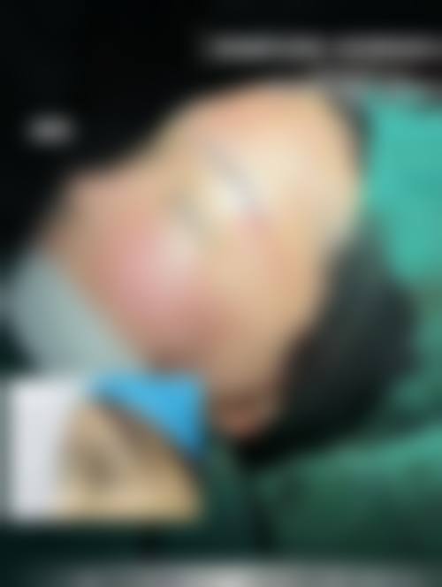 预约优惠活动:有什么隐藏限制吗?