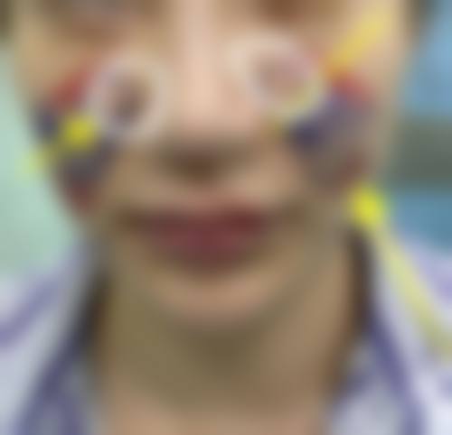 擅长项目详解:孙承用医生擅长做我需要的项目吗?