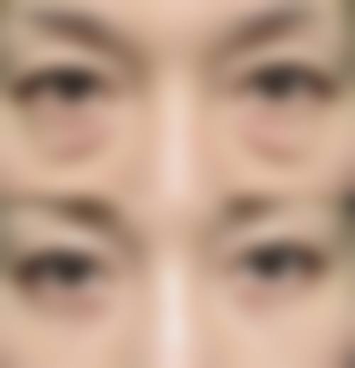 总结与预约号召