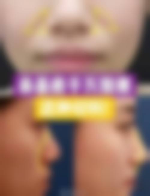 常见问题解答