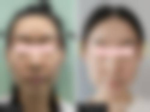 预约优惠活动