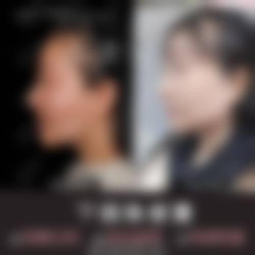 临床实例分享:治疗成效如何?