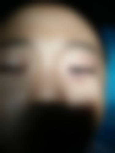 FAQ:谷城县人民医院眼科张元庆常见问题