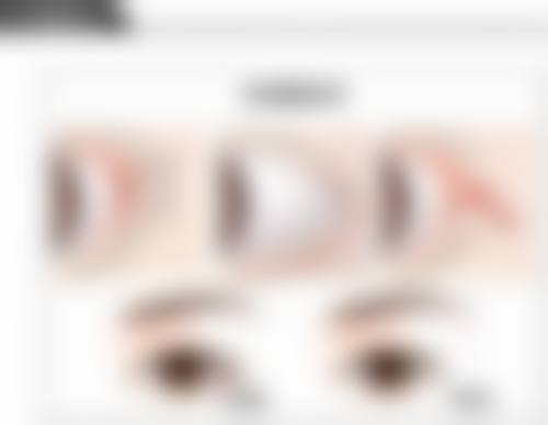 打瘦脸针后发现怀孕了有影响吗？