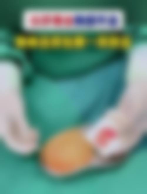 预约优惠活动