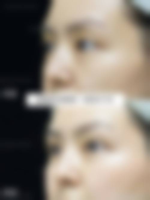 临床实例分享:真实反馈与成效见证