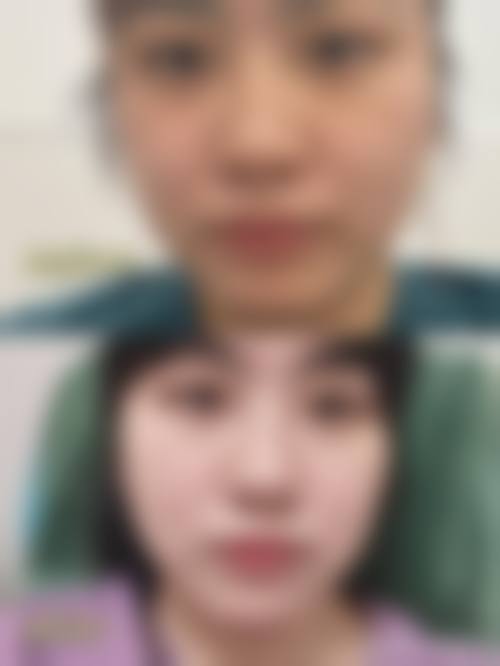 擅长项目详解:微创技术与个性化方案
