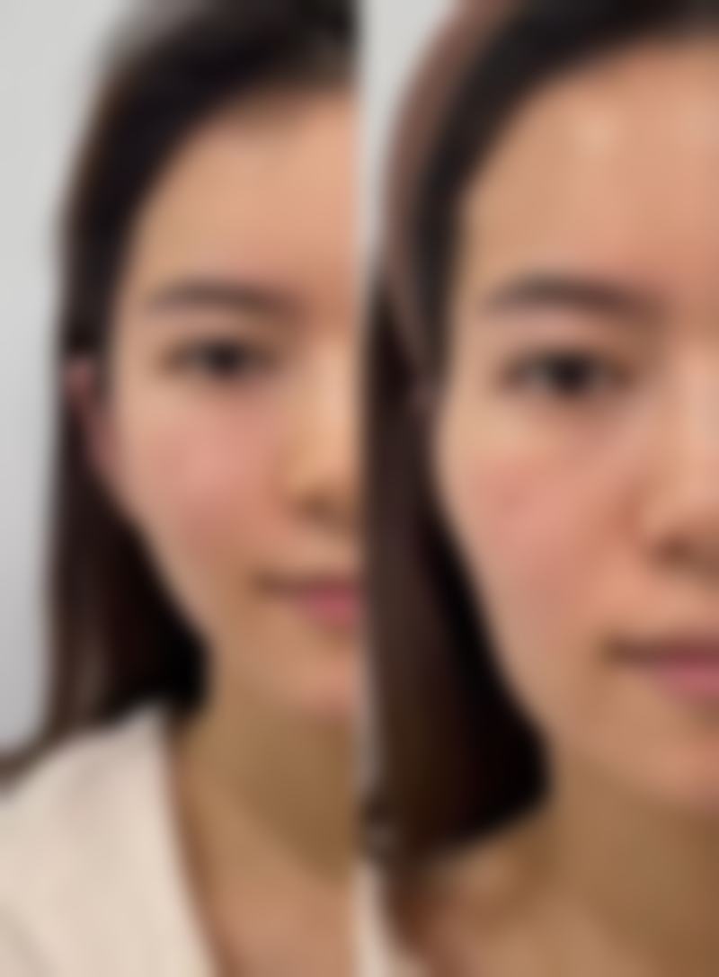 瘦脸针去哪里打才靠谱？避坑指南看这里