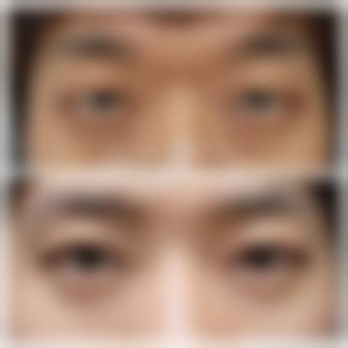 FAQ:常见问题答疑