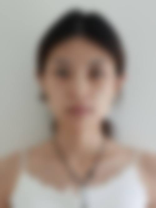合肥瑞亚医疗美容诊所参考价格表