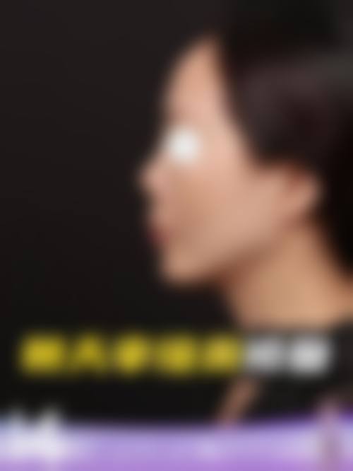 临床实例分享
