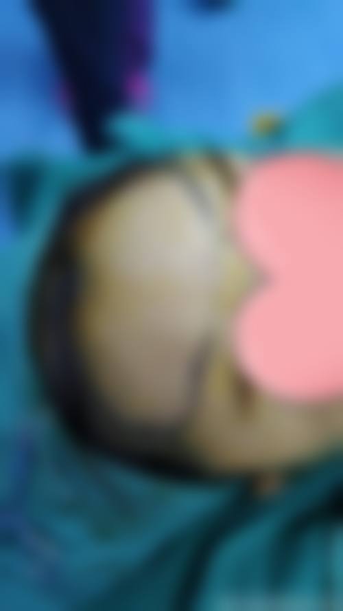 FAQ:关于深圳氧颜蔻医疗美容诊所张铭强