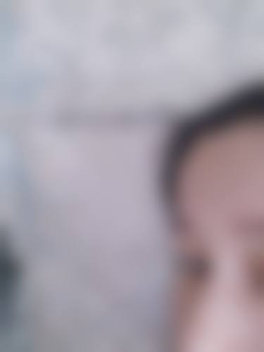 擅长项目详解:深圳氧颜蔻医疗美容诊所张铭强