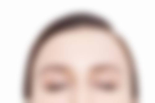 临床实例分享:深圳氧颜蔻医疗美容诊所张铭强