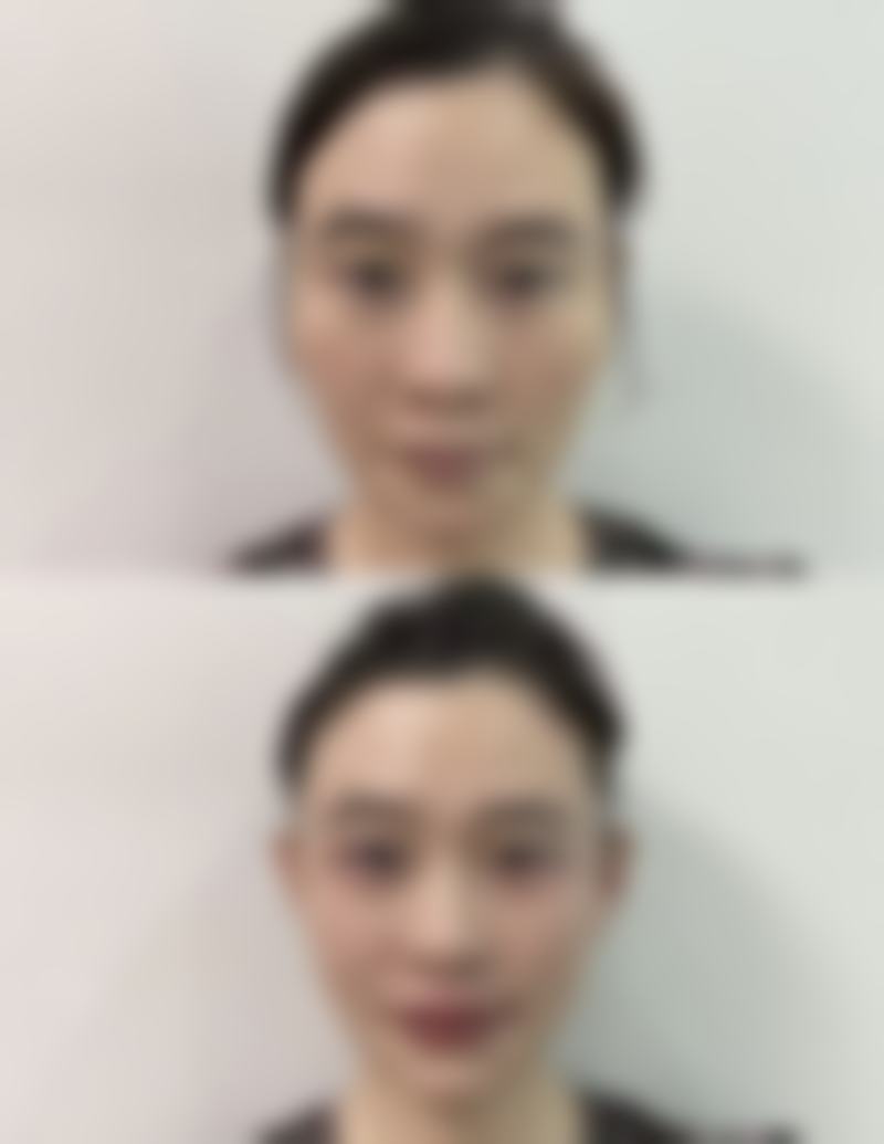 贵阳新生医疗美容门诊部参考价格表