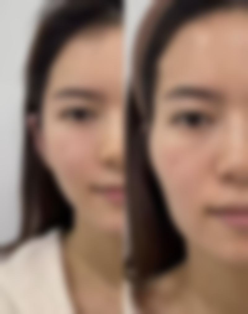 威海环翠区研几医疗美容诊所参考价格表