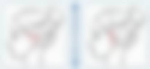 嘴唇上翘相关调整项目价格参考