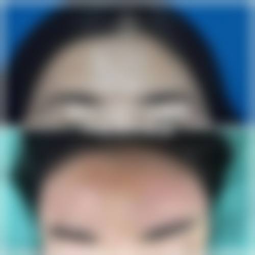 梁勋哲医生擅长项目