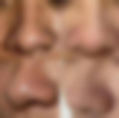 临床实例分享