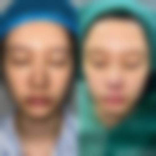 擅长项目详解:面部整形与微整技术