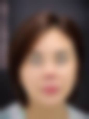 常见问题解答:消除疑虑放心变得更美