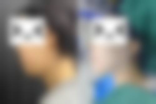结尾预约号召:何明武医生预约指南