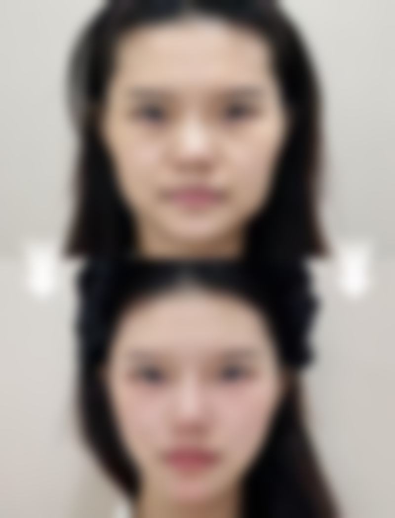 河科 大一附院整形美容科是正规的吗？
