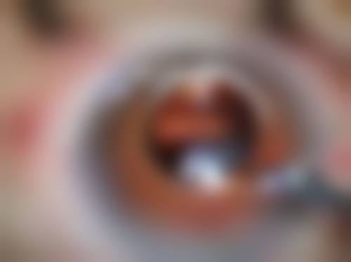 预约优惠活动:限时补贴不容错过