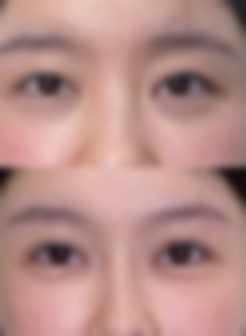 美白针全身美白能保持多久?怎么延长维持时间