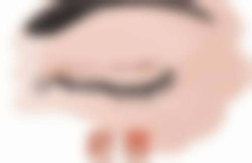 紧缩手术后多久能下床?多久可以拆线?