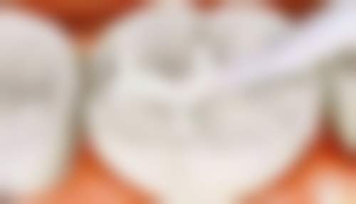 深圳冷伟琪口腔诊所:专精资质与舒适体验的双重保护