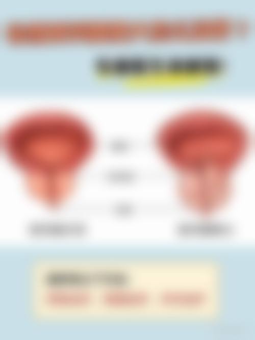 FAQ:常见问题解答