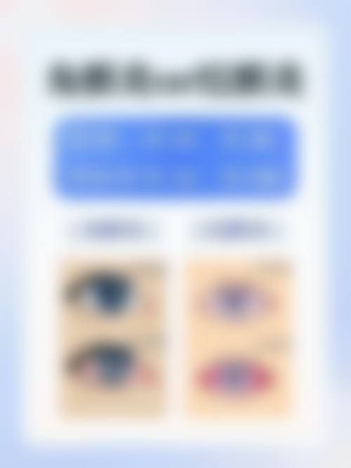 临床实例分享:李伟娟医生的真实反馈