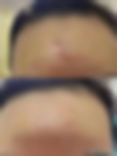 重庆嘉禾整形医院参考价格表