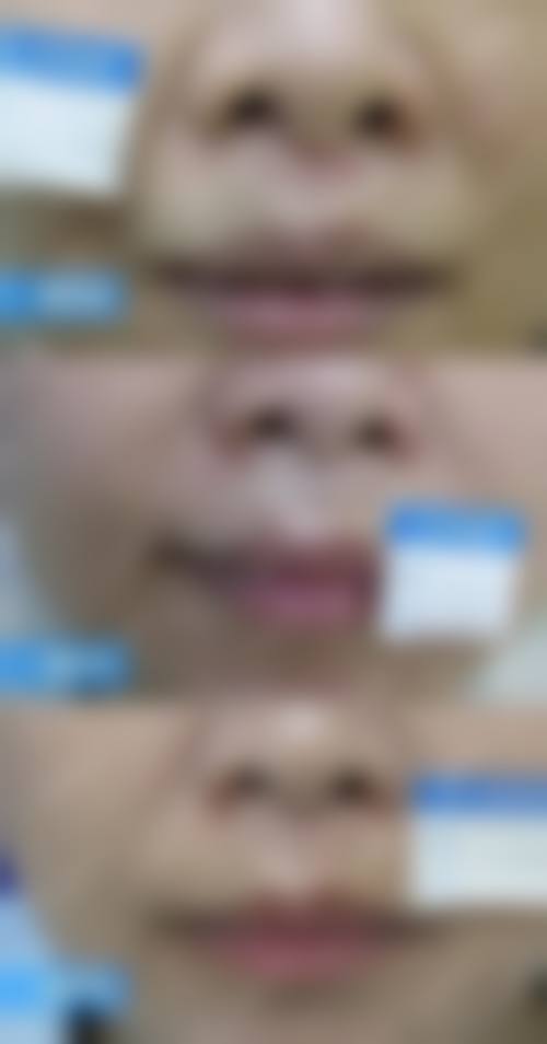 应晓红医生口碑评价