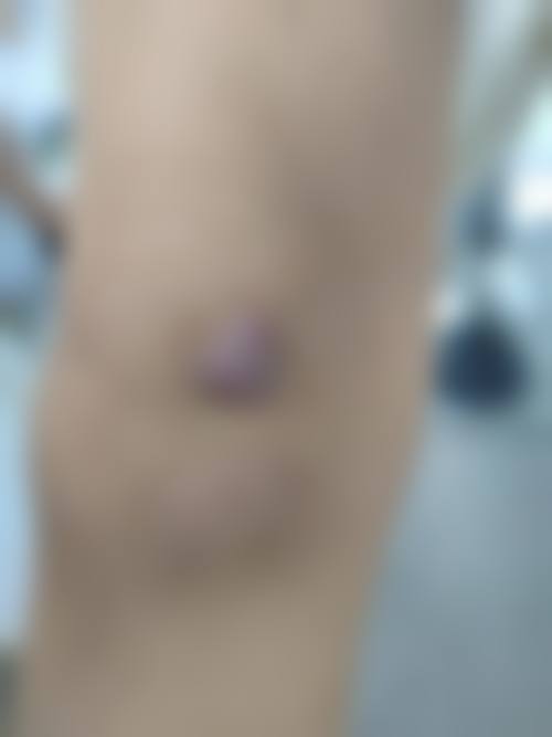 特色科室项目与价格参考指南