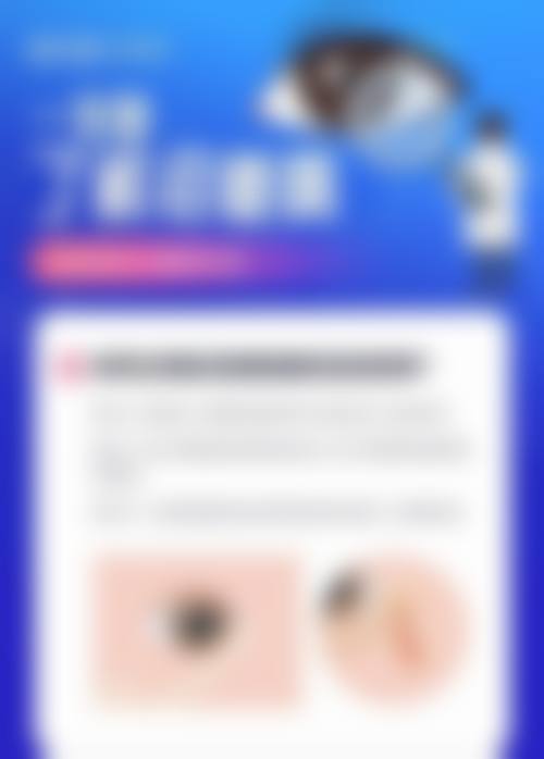 FAQ:常见问题解答