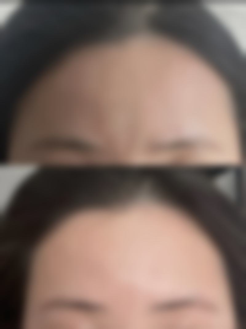 成都美未央医疗美容参考价格表