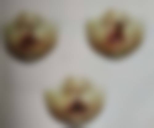 瘦脸针打完脸部凹陷慢慢能修复吗?