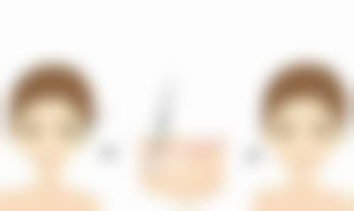瘦脸针打完肿了怎么回事?是正常反应吗?