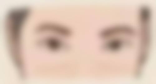 瘦脸针打完注意事项有哪些?多久可以平躺?