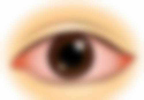 诊疗特色总结：南昌大学第四附属医院眼科温海峰