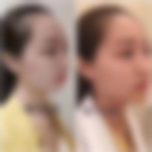 预约优惠活动