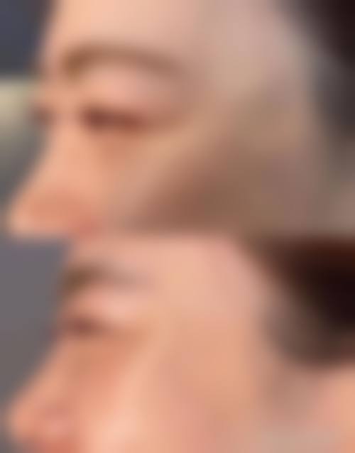 临床实例分享