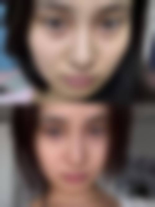 擅长项目详解