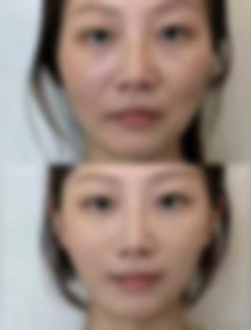 韩国PROPOSE整形医院高性价比变得更美方案有哪些